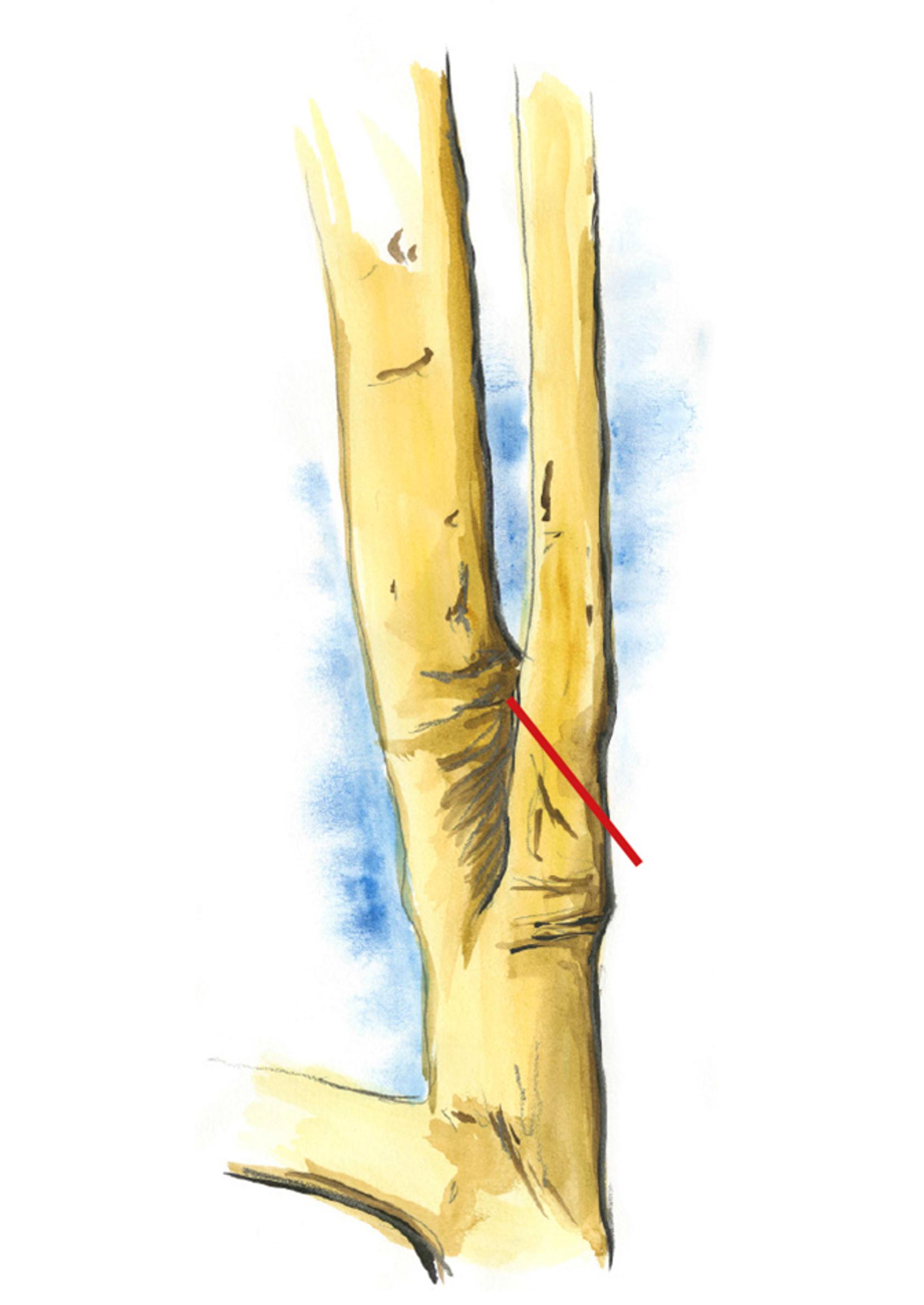 How to prune a young apple tree